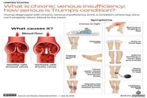 Chronic Venous Insufficiency